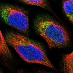 PNPLA8 Antibody, Novus Biologicals:Antibodies:Primary Antibodies